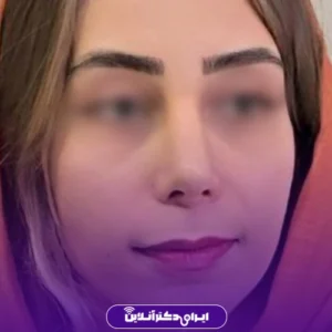 نمونه کار عمل بینی دکتر حبیب سهرابی 7