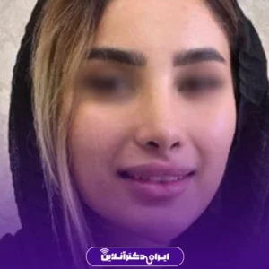 نمونه کار عمل بینی دکتر حبیب سهرابی 8
