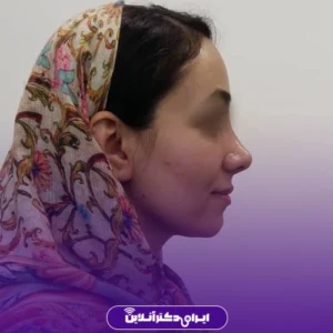 نمونه کار عمل بینی دکتر مهرداد امیرآبادی شیراز 1