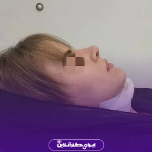 نمونه کار عمل بینی دکتر مهرداد امیرآبادی شیراز 7