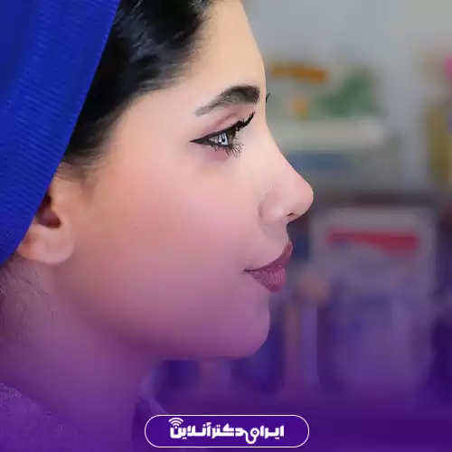 بهترین جراح بینی خانم در تهران 40 نمونه کار عمل بینی دکتر مریم بحری 1