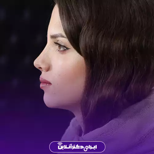 بهترین جراح بینی خانم در تهران 42 نمونه کار عمل بینی دکتر مریم بحری 3