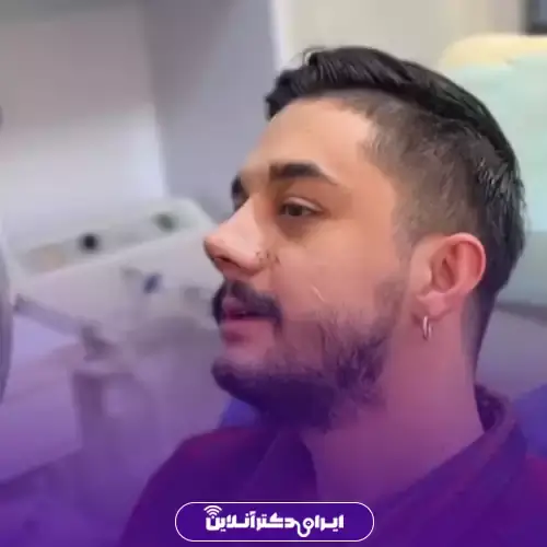 بهترین جراح بینی مردانه در تهران + لیست ۱۰ مورد از بهترین جراحان 120 نمونه کارهای عمل بینی مردانه دکتر محمود راسخی 3