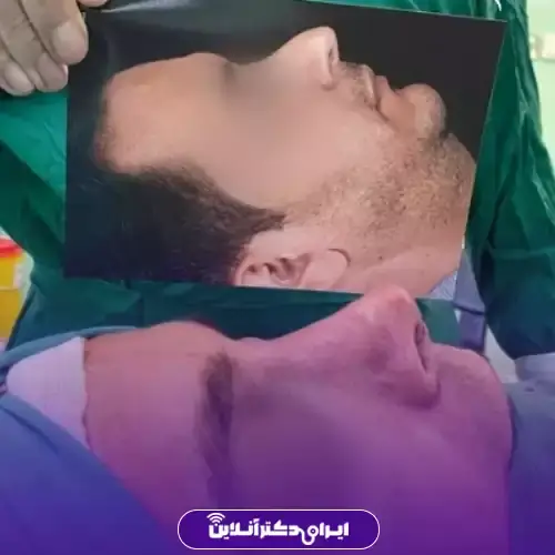 بهترین جراح بینی مردانه در تهران + لیست ۱۰ مورد از بهترین جراحان 106 نمونه کارهای عمل بینی مردانه دکتر ابوالفضل عباس زاده 4
