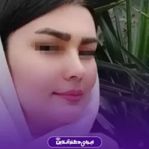 نمونه کار عمل بینی دکتر علی حیدری معاف 1