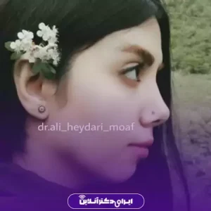 نمونه کار عمل بینی دکتر علی حیدری معاف 10