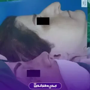 نمونه کار عمل بینی دکتر علی حیدری معاف 3