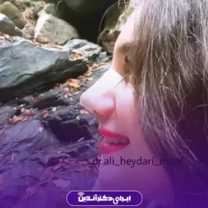 نمونه کار عمل بینی دکتر علی حیدری معاف 7