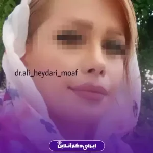 نمونه کار عمل بینی دکتر علی حیدری معاف 9
