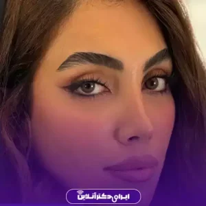 نمونه کار عمل بینی دکتر امیر بیاتیان 1