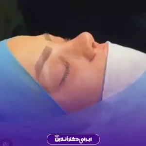 نمونه کار عمل بینی دکتر امیر بیاتیان 2