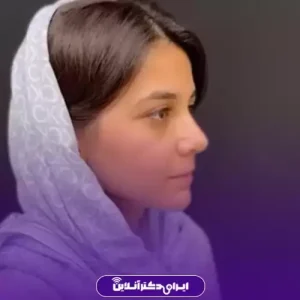 نمونه کار عمل بینی دکتر امیر بیاتیان 3