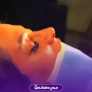 نمونه کار عمل بینی دکتر امیر بیاتیان 5