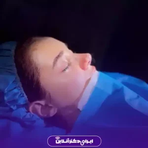 نمونه کار عمل بینی دکتر امیر بیاتیان 6