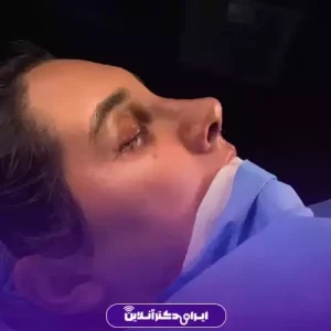 نمونه کار عمل بینی دکتر امیر بیاتیان 7