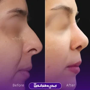 نمونه کار دکتر آرش نجف بیگی - 10