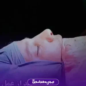 نمونه کار عمل بینی طبیعی دکتر کمال هادی 1