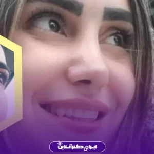 نمونه کار عمل بینی طبیعی دکتر کمال هادی 2