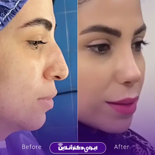 بهترین جراح بینی استخوانی در تهران + لیست 8 پزشک متخصص 117 نمونه کار عمل بینی دکتر خسرو مقتدر 2