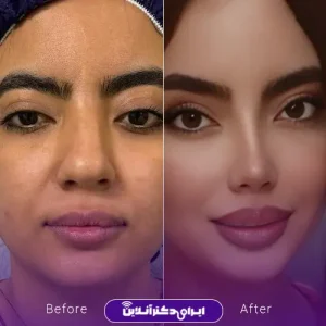 نمونه کار عمل بینی دکتر خسرو مقتدر 1