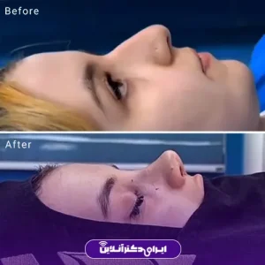 نمونه کار عمل بینی دکتر خسرو مقتدر 10