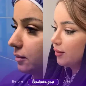 نمونه کار عمل بینی دکتر خسرو مقتدر 6