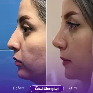 نمونه کار عمل بینی دکتر خسرو مقتدر 7