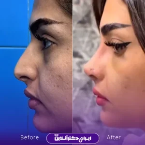 نمونه کار عمل بینی دکتر خسرو مقتدر 8