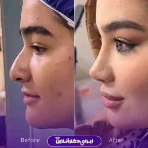 نمونه کار عمل بینی دکتر خسرو مقتدر 9