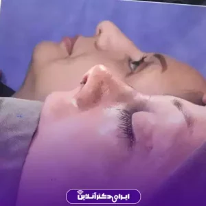 نمونه کار عمل بینی دکتر مریم عبداللهی 5