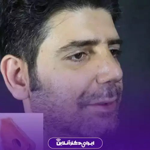 بهترین جراح بینی مردانه در تهران + لیست ۱۰ مورد از بهترین جراحان 95 نمونه کارهای عمل بینی مردانه دکتر حمیدرضا راستی 2