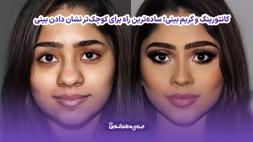 چگونه پره های بینی را کوچک کنیم؛ همه چیز درباره عمل آلارپلاستی 3 کانتورینگ و گریم بینی؛ سادهترین راه برای کوچکتر نشان دادن بینی