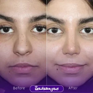 نمونه کار دکتر فرشته عصمتی نیا - 10