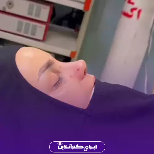 بهترین جراح بینی فانتزی در تهران (لیست 10 پزشک برتر + نمونه کار) 139 نمونه کار قبل و بعد عمل بینی فانتزی دکتر اکبر اعتمادی 3