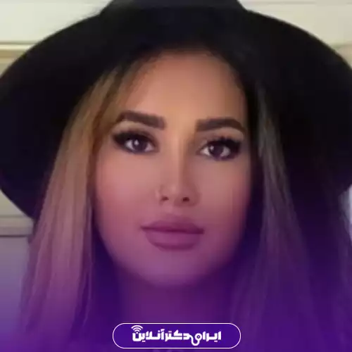 بهترین جراح بینی فانتزی در تهران (لیست 10 پزشک برتر + نمونه کار) 124 نمونه کار قبل و بعد جراحی بینی فانتزی دکتر علی جاودانی 4
