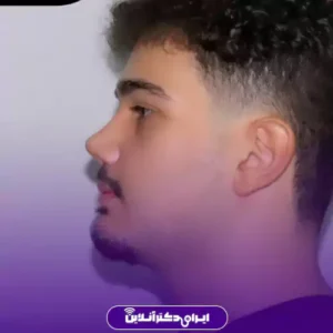 نمونه کار عمل بینی دکتر ابراهیم فهیم نیا 1