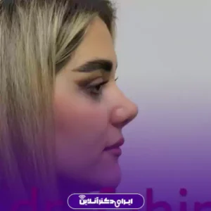 نمونه کار عمل بینی دکتر ابراهیم فهیم نیا 4