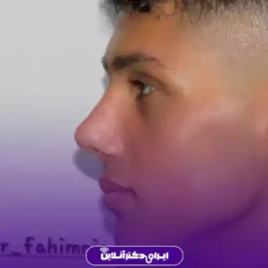نمونه کار عمل بینی دکتر ابراهیم فهیم نیا 6