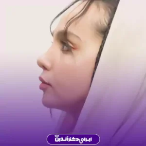 نمونه کار عمل بینی دکتر ابراهیم فهیم نیا 7