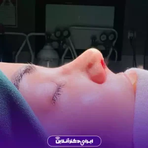 نمونه کار عمل بینی دکتر فرهام احمدی 2