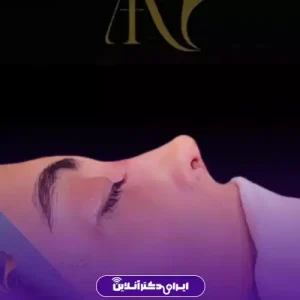 نمونه کار عمل بینی دکتر فرهام احمدی 4