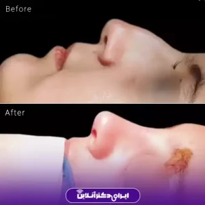 نمونه کار عمل بینی دکتر حمیرا رشدی 10