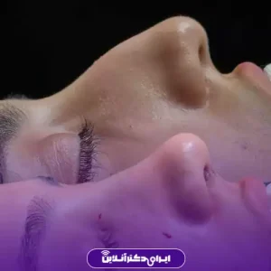 نمونه کار عمل بینی دکتر حمیرا رشدی 2