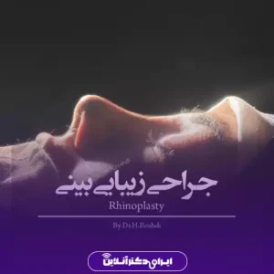 نمونه کار عمل بینی دکتر حمیرا رشدی 6