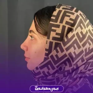 نمونه کار عمل بینی دکتر حمیرا رشدی 7