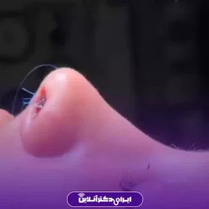 نمونه کار عمل بینی دکتر حمیرا رشدی 9