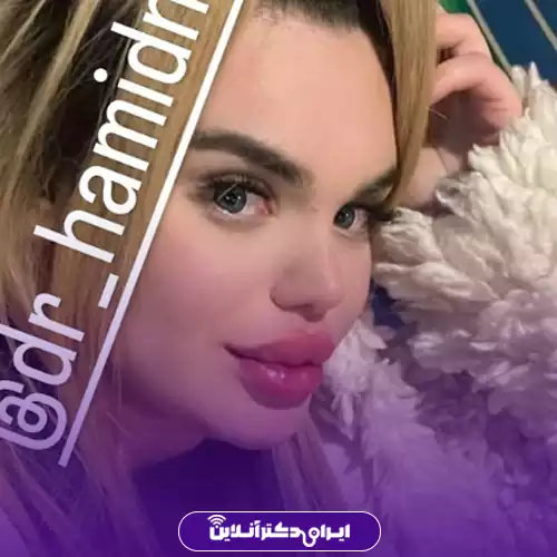بهترین جراح بینی فانتزی در تهران (لیست 10 پزشک برتر + نمونه کار) 158 نمونه کار جراحی بینی مدل فانتزی توسط دکتر حمید نوری 2
