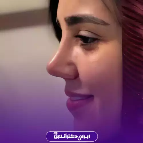 بهترین جراح بینی فانتزی در تهران (لیست 10 پزشک برتر + نمونه کار) 162 نمونه کار عمل بینی فانتزی دکتر احمدعلی رجبپور 1