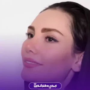 نمونه کار عمل بینی دکتر امیر نیازی 5