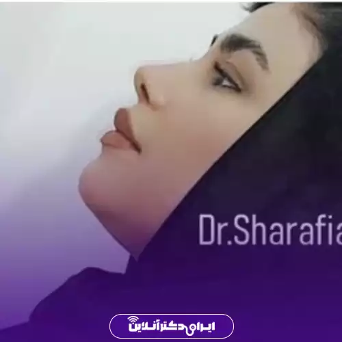 نمونه کار عمل بینی دکتر آرش شرفیان 6